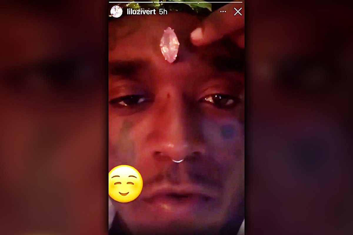 Lil Uzi Vert Responds to People Saying His Diamond Face Implant Isn’t Centered