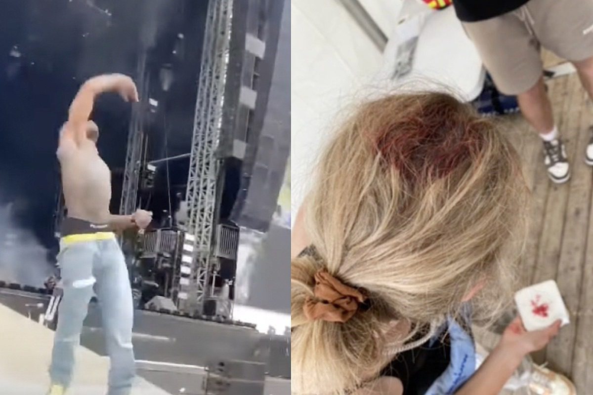 Lil Uzi Vert Throws Phone Into Crowd Mid-Performance, Allegedly Hits Woman In the Head Leaving Bloody Injury