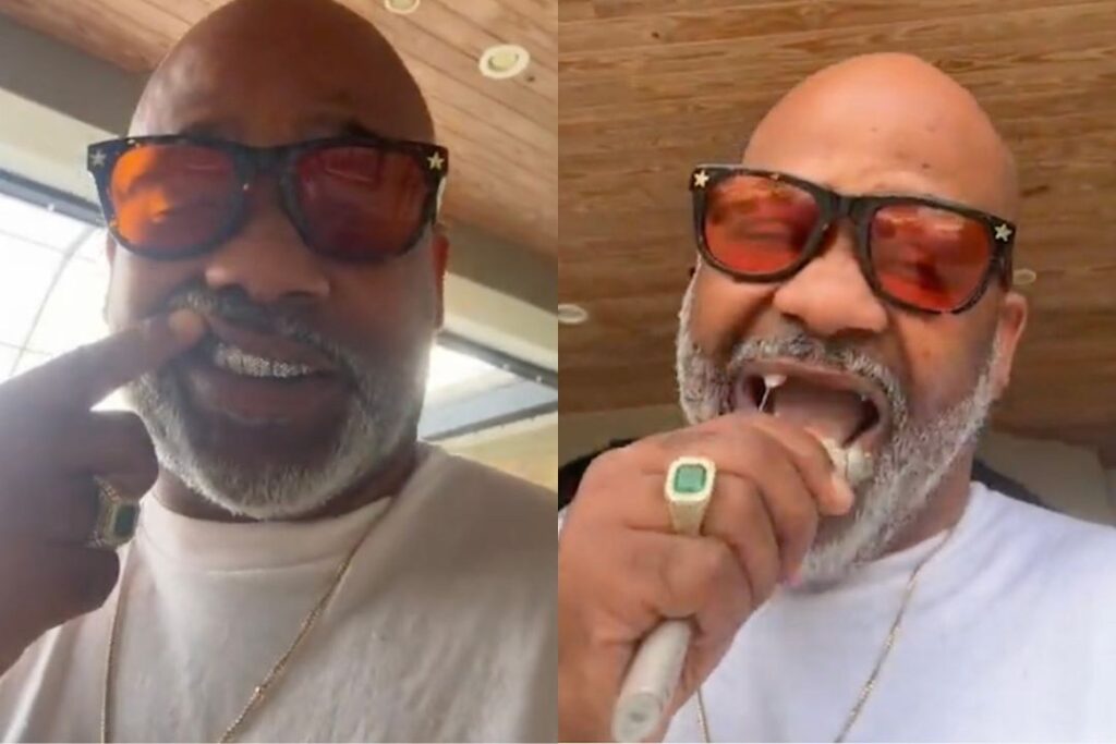 Dame Dash Shows Missing Teeth After Grills Fall Out of His Mouth