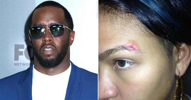 Sean Combs’ Ex Cassie Ventura’s Gruesome Injuries Revealed