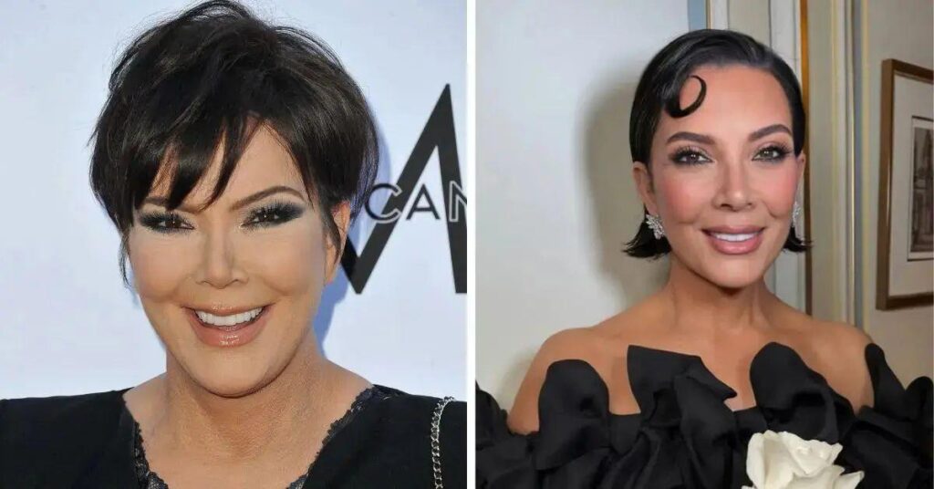 Photo of Kris Jenner revealed she and her plastic surgeon, Steven Levine, came up with a password to filter clients.