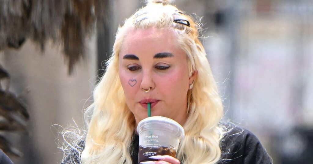 image of The 'Easy A' alum recently got lip injections.