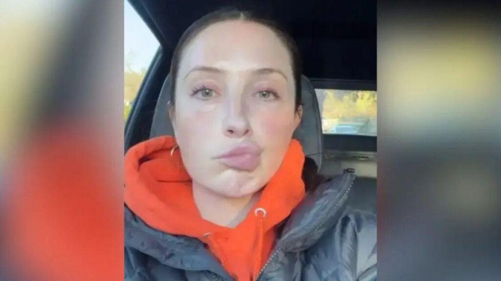 Photo of The reality star's face began 'looking a little weird' in January 2025.